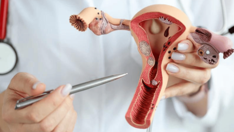 Treatment For Uterine Fibroids