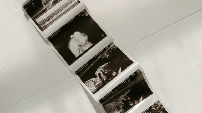 birth defects feature image