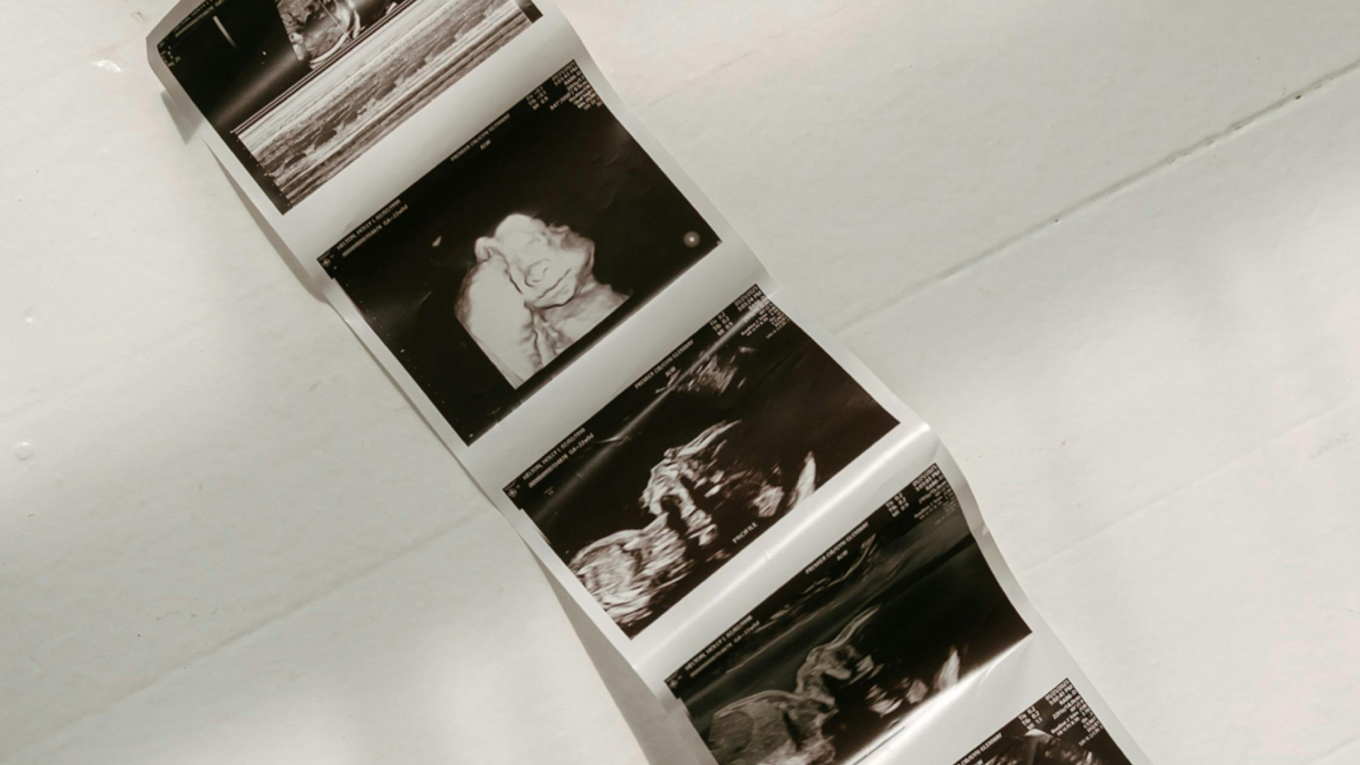 birth defects feature image