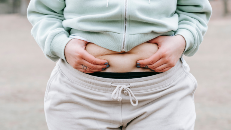 How to Get Rid of Hormonal Belly
