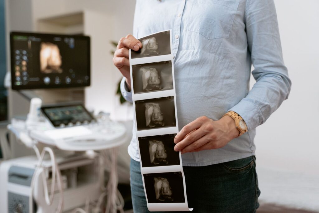 Woman holding a printed ultrasound image of her baby